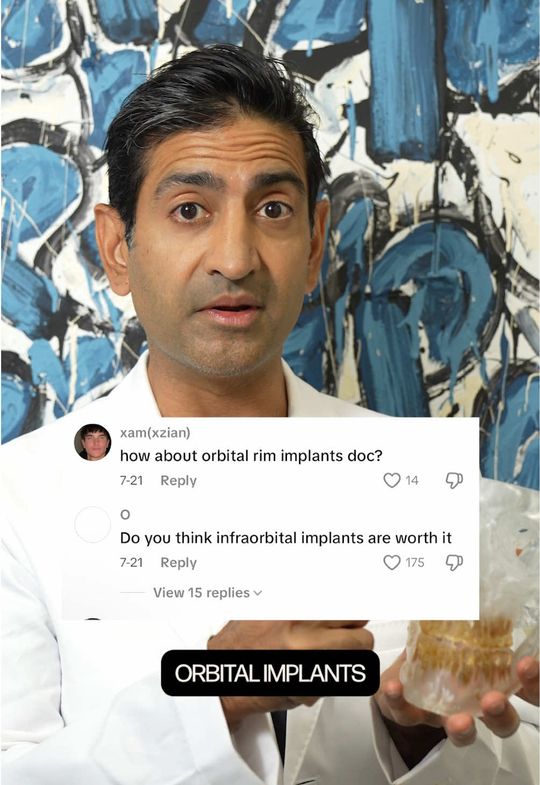 Video by Dr. Karan Dhir: I’ve been getting a lot of questions about 👁️ orbital implants — so let’s clear it up! These go…