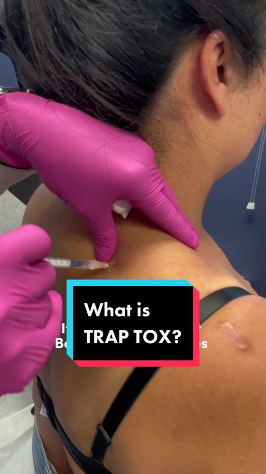 Video by Dr. Kay Durairaj: Have you heard about ? 🤔