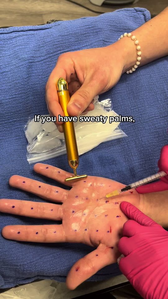 Video by Dr. Kay Durairaj: The key to a sweat-free summer! 💧