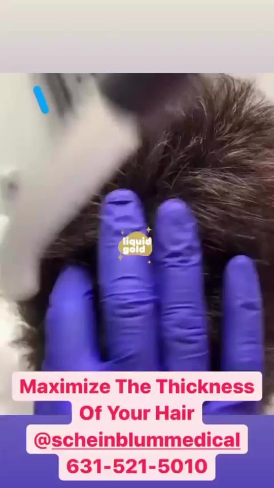 Video by Dr. Keith Scheinblum: is not just for people with hair loss ..it's also used to thicken and maintain what you have…call…