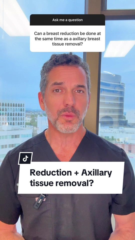 Video by Dr. Kevin Brenner: Axillary breast tissue is glandular tissue that can develop in the armpit, and is an extension of…