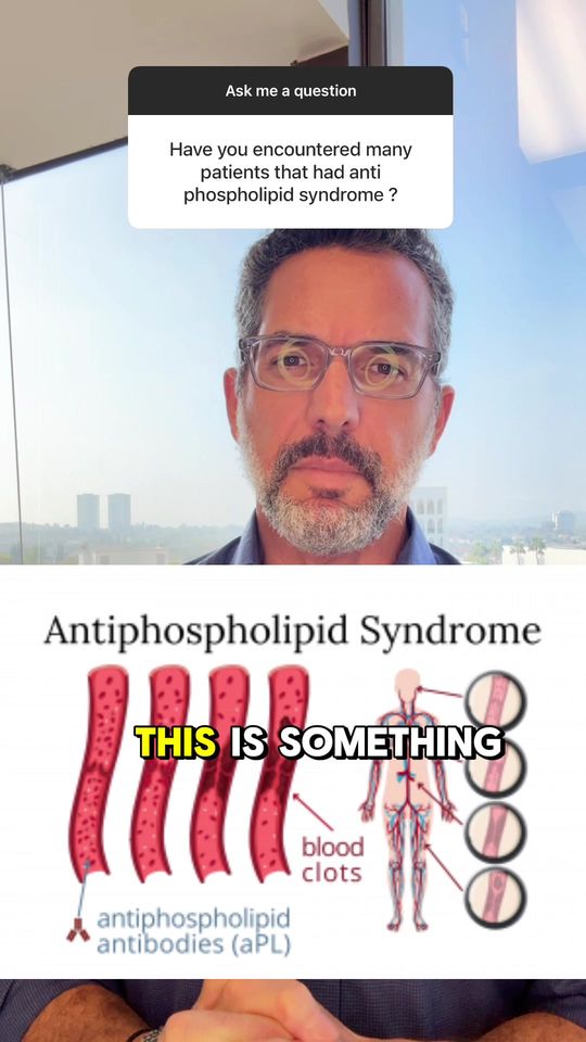 Video by Dr. Kevin Brenner: 🩸 Antiphospholipid syndrome (APS) is a rare autoimmune disorder that causes abnormal blood clots…