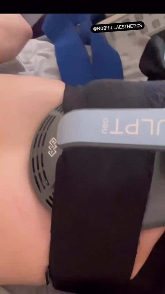 Video by Dr. Konstantin Bukov: Powerful contractions from the treatment 💪💪