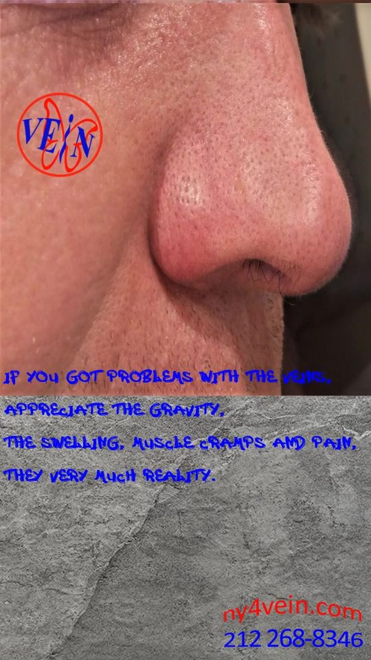 Video by Dr. L. Mark Khitin: About Veins