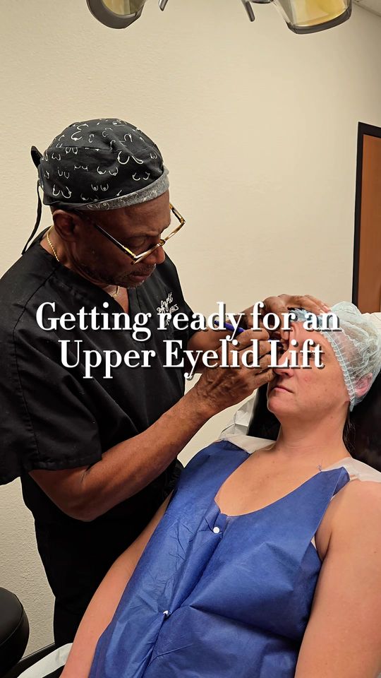 Video by Dr. Larry C. Leverett: 👁️✨ Ever wondered what an Upper Blepharoplasty (Upper Eyelid Lift) looks like? We filmed Dr. Lev…