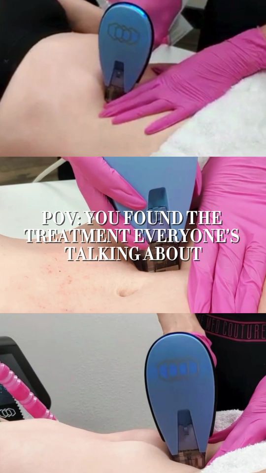 Video by Dr. Larry C. Leverett: Still feeling like your skin doesn’t match how hard you work on your body? Morpheus8 is where tig…