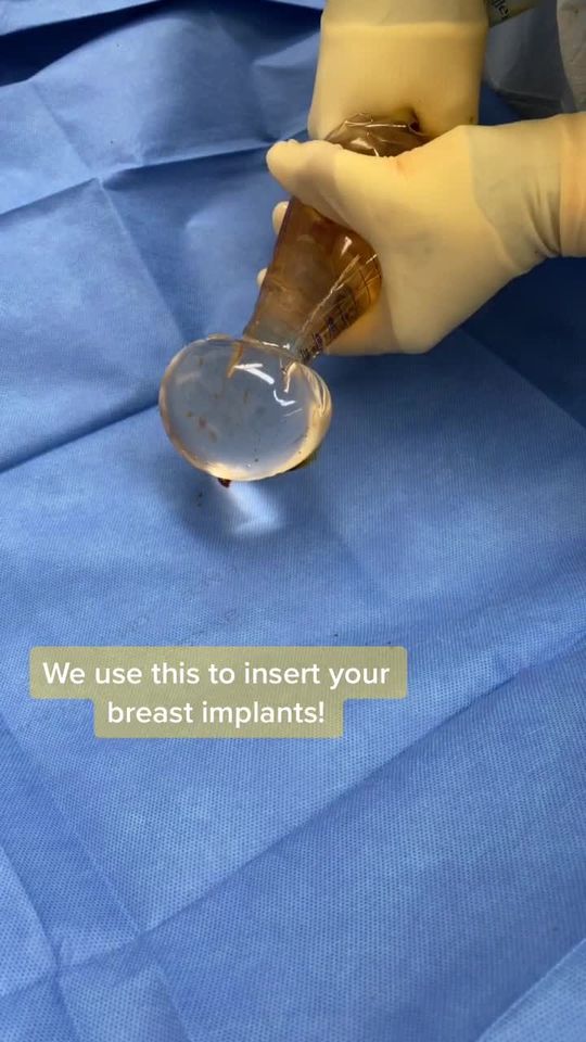 Video by Dr. Luis Macias: Fun fact of the day - this is how we insert silicone implants 🤓