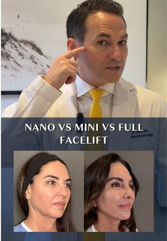Video by Dr. Mark G. Albert: If you’re considering facial rejuvenation surgery and don’t know where to start, this series is f…