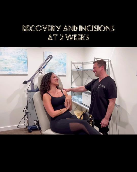 Video by Dr. Mark Karolak: This beautiful 51 yo had a neck lift and temporal lift 2 weeks ago!!! The video shows her recover…