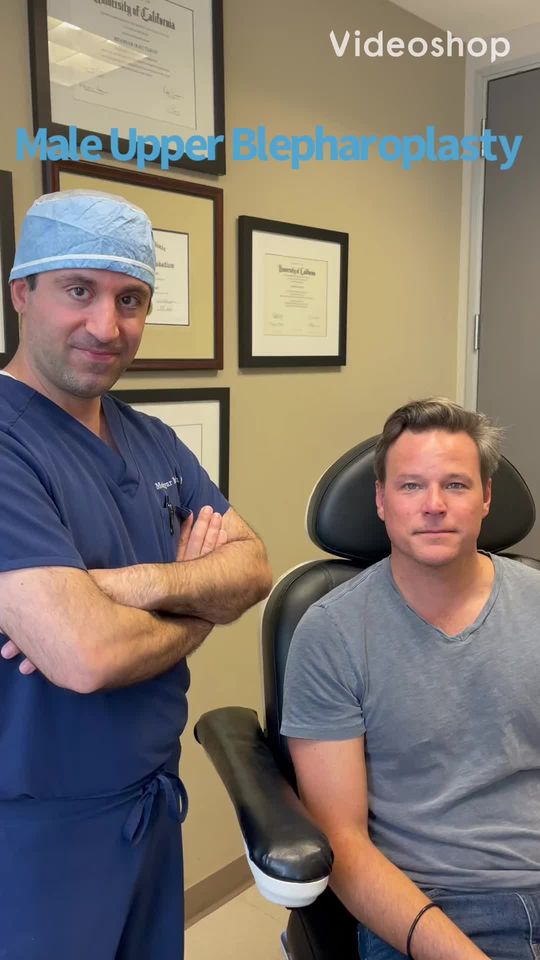 Video by Dr. Mehryar (Ray) Taban: CUSTOMIZED MALE UPPER BLEPHAROPLASTY: Middle age gentleman underwent customized conservative male…