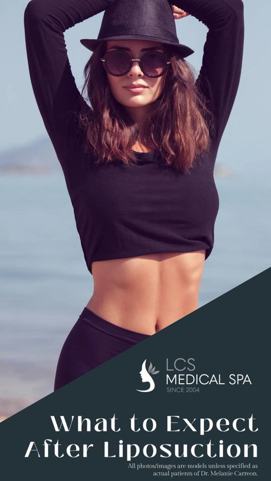 Video by Dr. Melanie Carreon: 🌟 Transforming Bodies, Empowering Lives! 🌟 Discover the truth about Liposuction: it's not just…