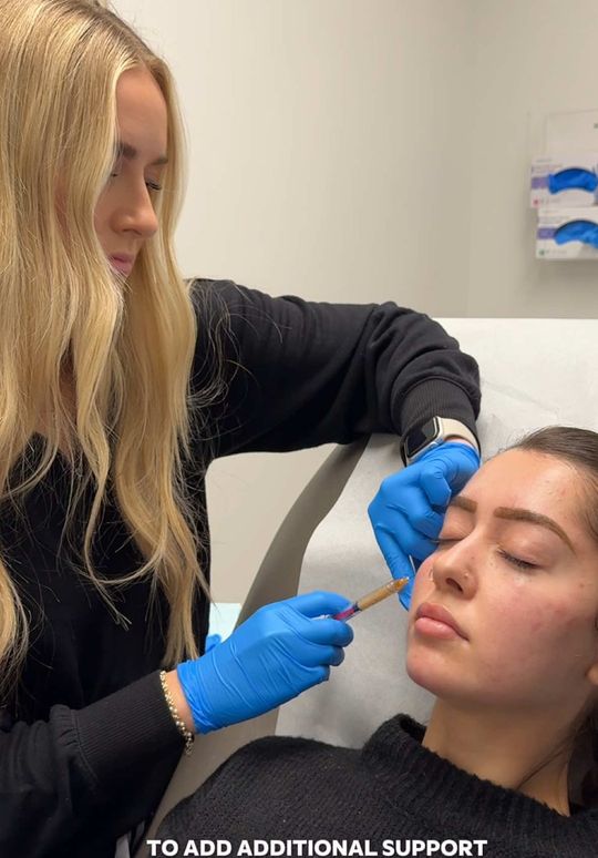 Video by Dr. Melissa Chiang: ⬇️👁️ Think you need undereye filler for hollowness? You might need cheek filler instead! Underey…