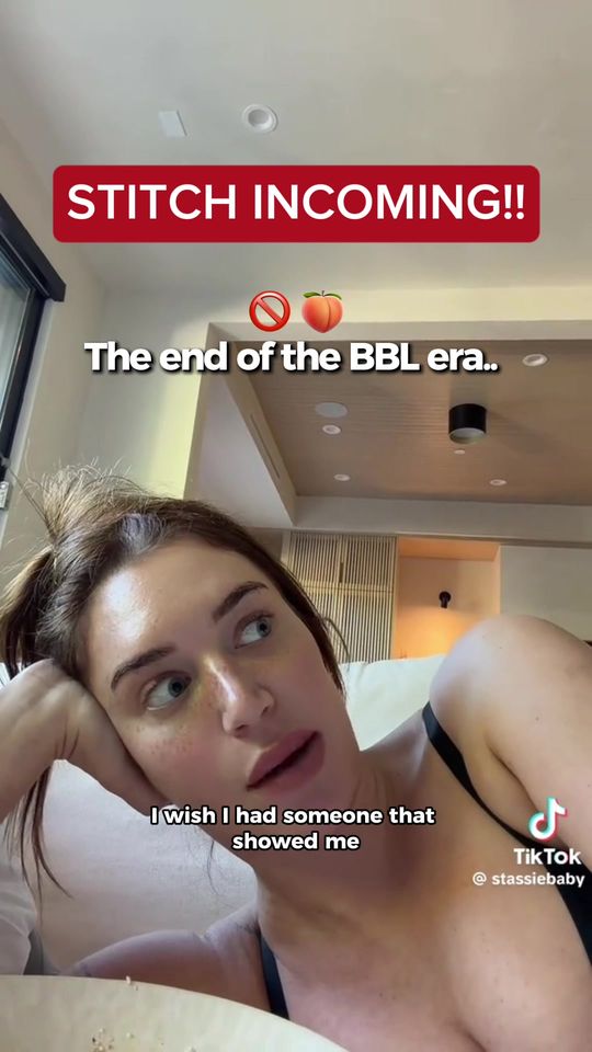 Video by Dr. Melissa Chiang: The BBL era might be... over? 😳🍑🚫 Natural curves are back and celebs like Alondra & Stassie ar…