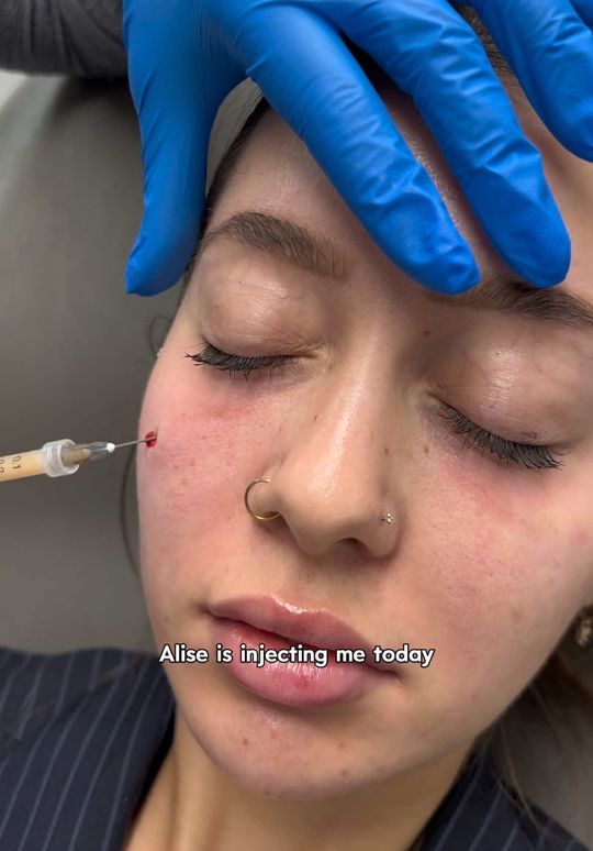 Video by Dr. Melissa Chiang: “You look tired.” 🫩 No matter how much sleep you get, some people just always look tired, someti…