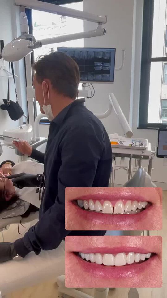 Video by Dr. Michael A. Apa: How's this for instant gratification? patients leave the first appointment with a new smile, desi…