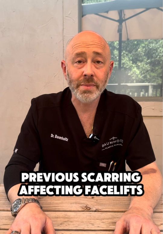 Video by Dr. Michael Baumholtz: If you don’t need a facelift now but know that you will want one in the future, THIS IS FOR YOU!…