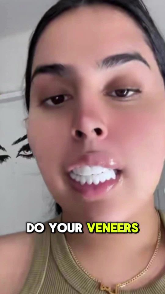 Video by Dr. Michael D. Kosdon: Top 5 Myths about Porcelain Veneers