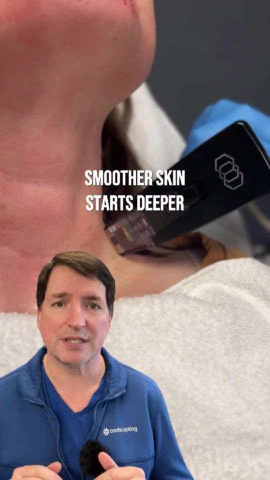 Video by Dr. Michael Kerin: Morpheus8 is popular because it doesn’t just focus on the surface of the skin. It combines micron…