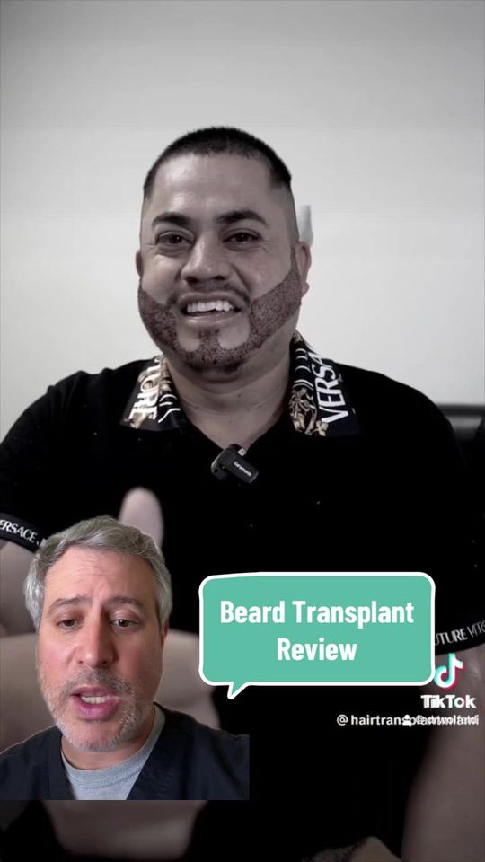 Video by Dr. Michael Wolfeld: Beard Hair Transplant! Expert hair surgeon Dr. Wolfeld reviews. Wolfeld Hair 📍New York, NY 📆Boo…