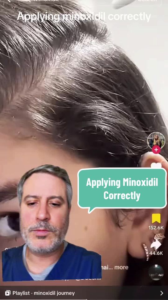 Video by Dr. Michael Wolfeld: Minoxidil Spray is most effective at helping to regrow your hair when applied correctly. Dr. Wolf…