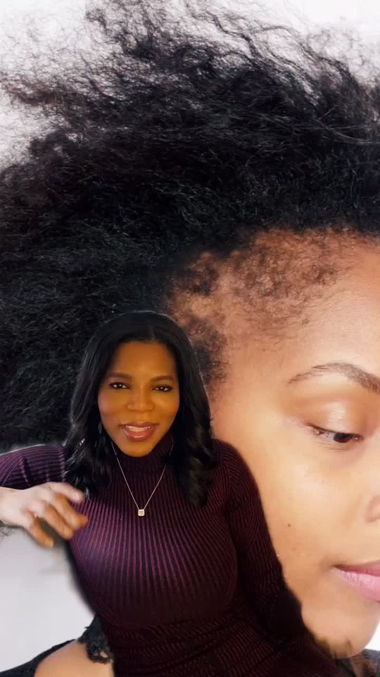 Video by Dr. Michelle Henry: Traction Alopecia✨