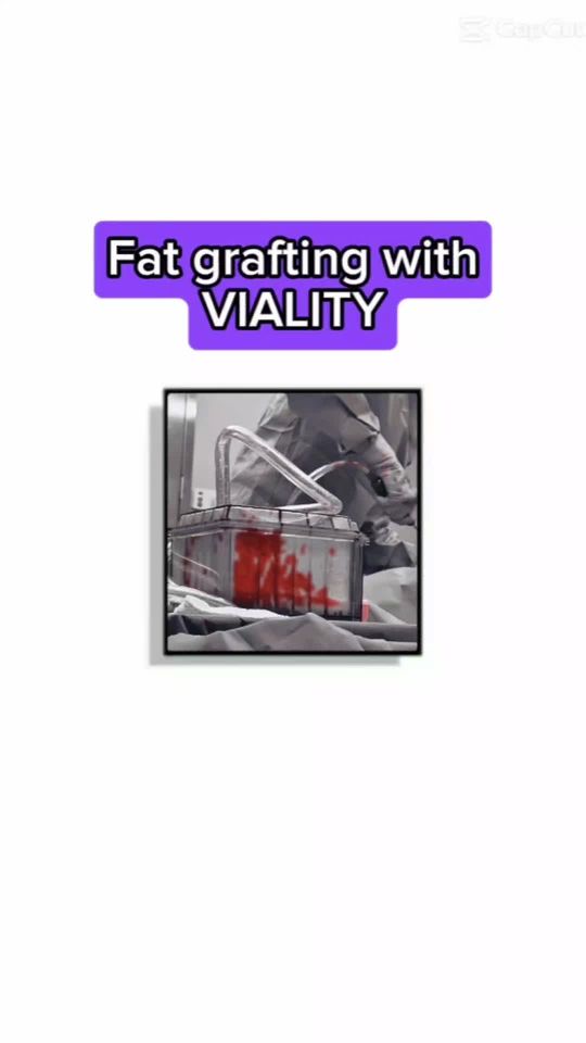Video by Dr. Mihail Climov: Interested in learning about fat grafting with Viality? Follow for more or call for a consultation