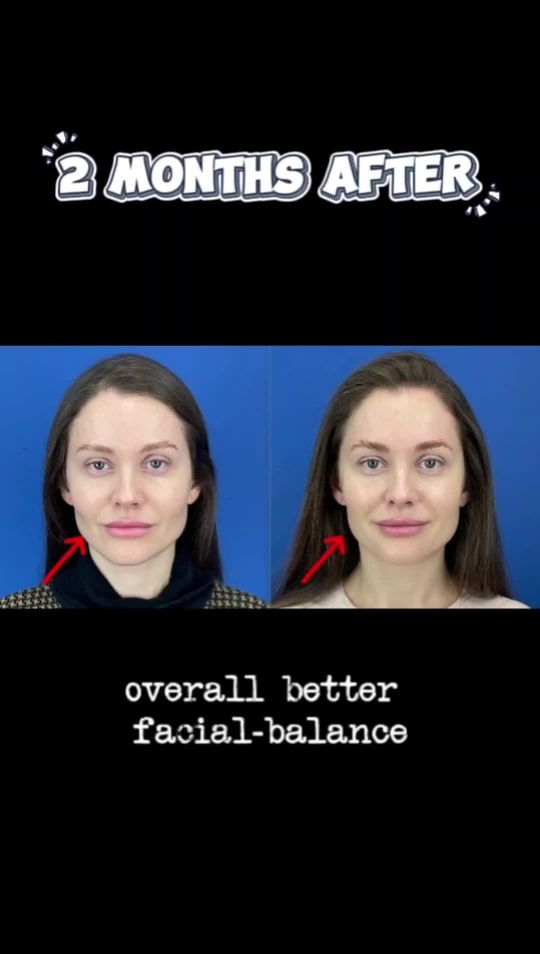 Video by Dr. Mihail Climov: Balanced Beauty in Motion ✨ Meet Anastasia, a stunning fitness model and coach with body fat leve…