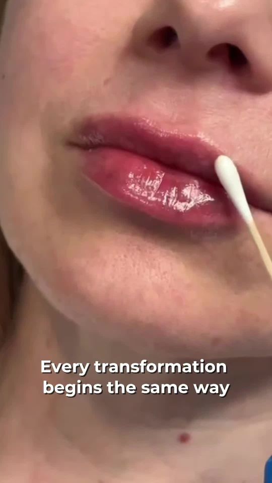 Video by Dr. Mihail Climov: Not every face should look the same — because not every story is. This wasn’t about trends or fil…