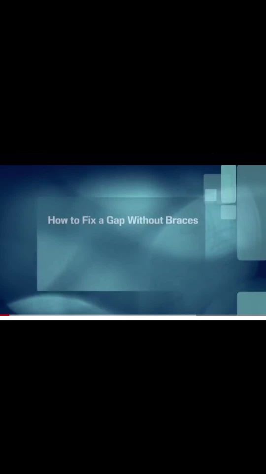 Video by Dr. Mitchell A. Josephs: Hw to fix a gap without braces