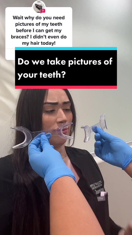 Video by Dr. Monica Velez, D: from @applevalleyorthodontics_ We will take pictures of your face and teeth when your ready for t…