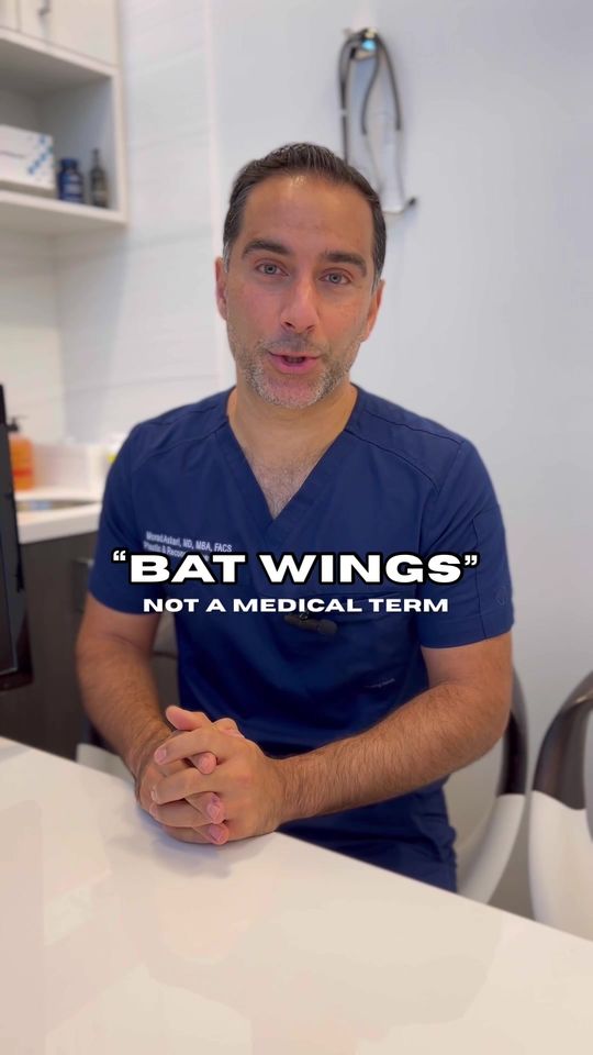 Video by Dr. Morad Askari: Have you heard of “bat wings” before?