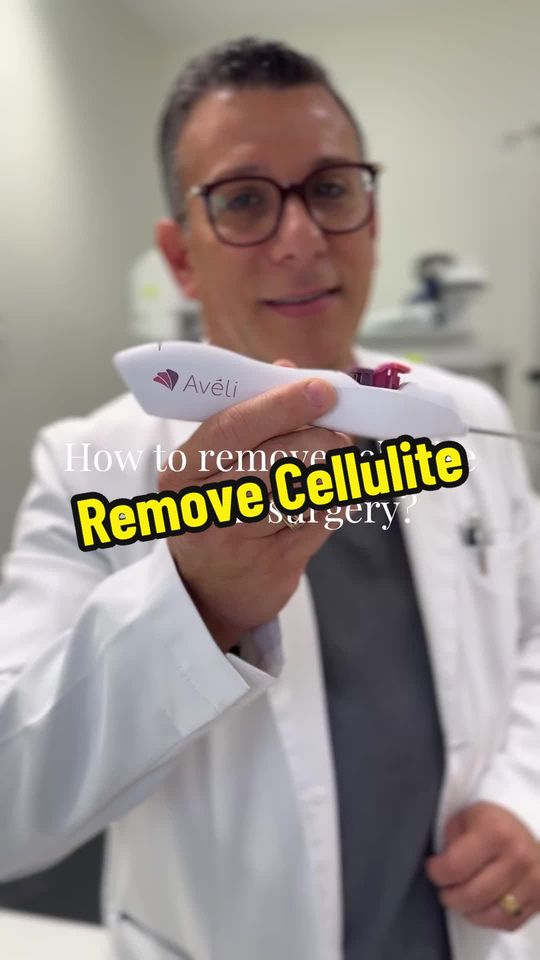 Video by Dr. Morad Askari: Avéli is a handheld device that goes underneath the skin to cut the fibrous bands that tether you…
