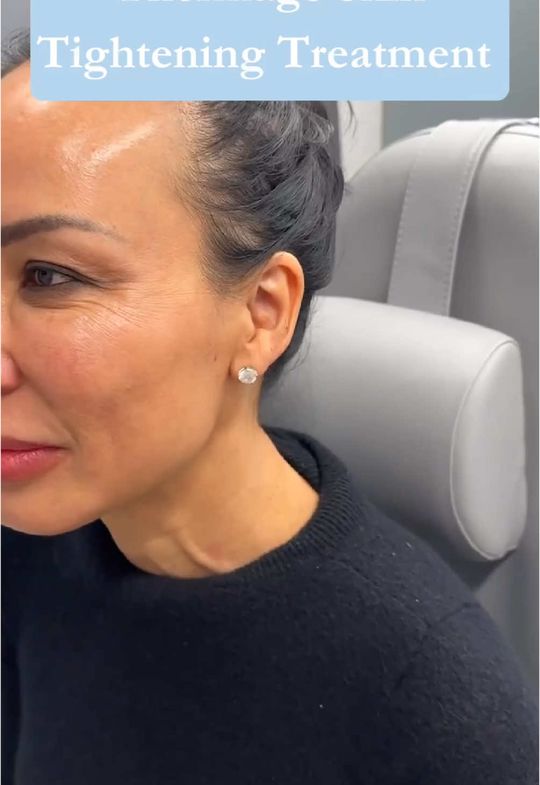Video by Dr. Mytien Goldberg: I always try out all possible treatments I may recommend to my patients, and was no exception! Ta…