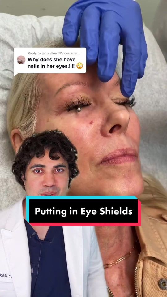 Video by Dr. Nadir Qazi: We also use numbing eyedrops before putting them in