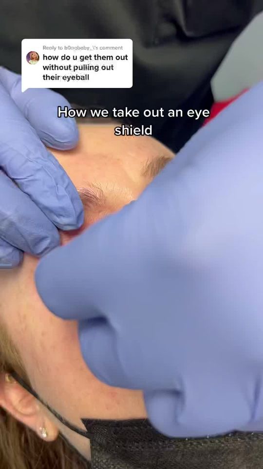 Video by Dr. Omar Ibrahimi: for those that were curious.