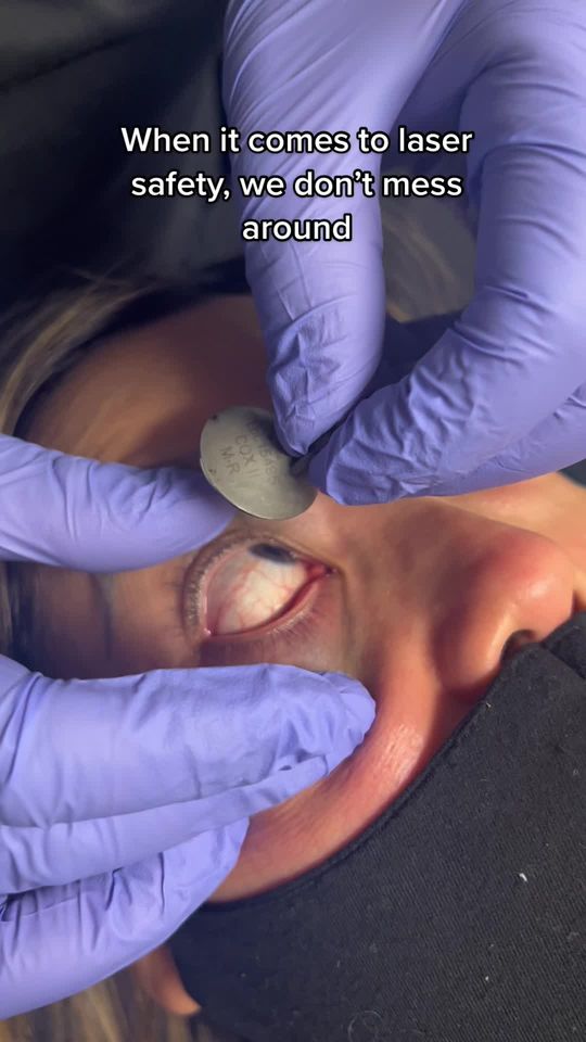 Video by Dr. Omar Ibrahimi: Laser safety