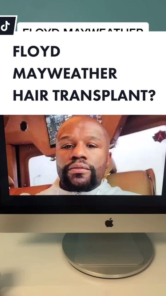 Video by Dr. Parsa Mohebi: FLOYD MAYWEATHER HAIR TRANSPLANT? |