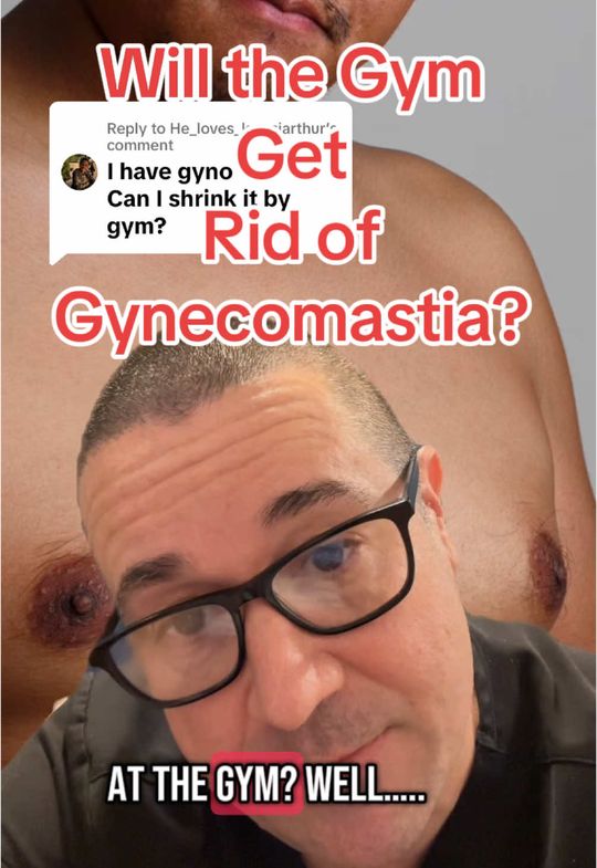 Video by Dr. Paul M. Pearce: Replying to @He_loves_kwesiarthur Gynecomastia doesn’t always go away with diet and exercise. Her…