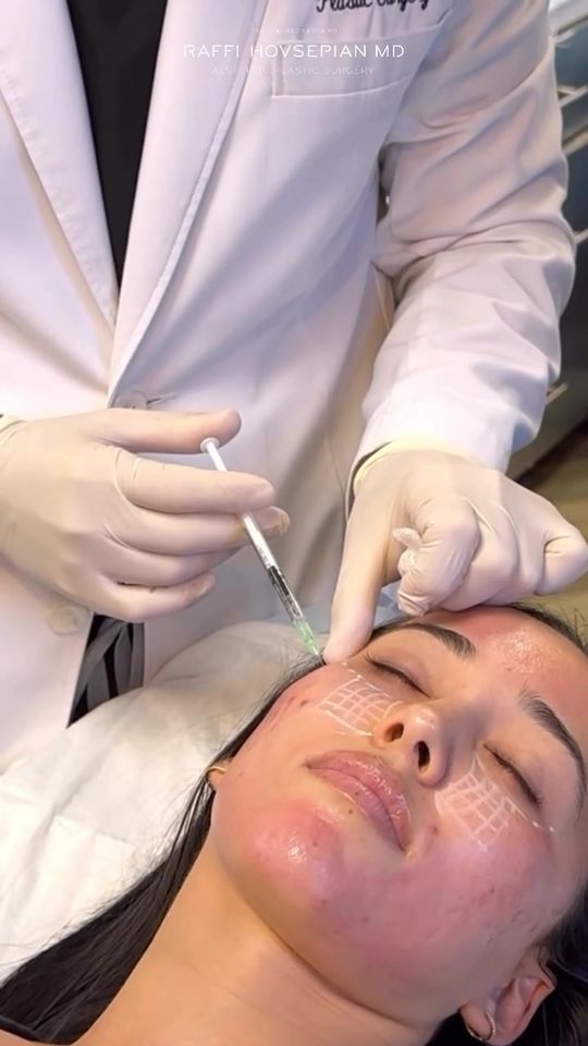 Video by Dr. Raffi Hovsepian: Custom Combination Non-Invasive Treatments with Dr. Raffi Hovsepian: Redefining Facial Rejuvenati…