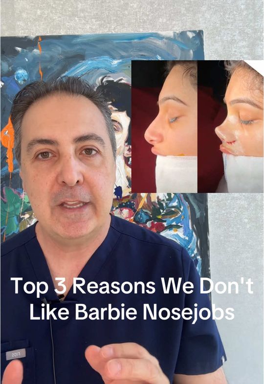 Video by Dr. Raffy Karamanoukian: Turkish Barbie nose rhinoplasties can actually be so extreme that they disrupt the normal harmony…