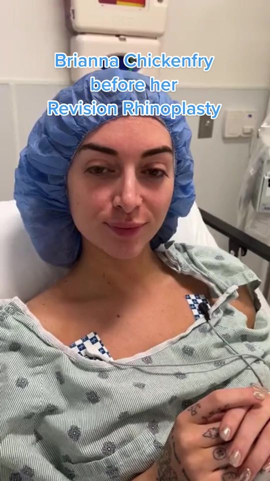 Video by Dr. Ramtin Kassir: @briannachickenfry before her nose job