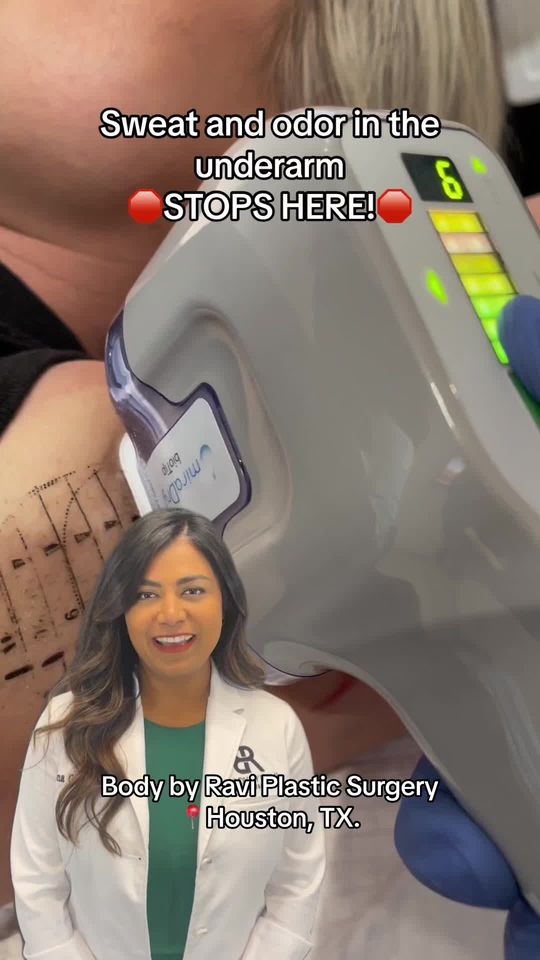 Video by Dr. Ravi Somayazula: MiraDry is the first cleared procedure to permanently reduce excessive sweat and odor!