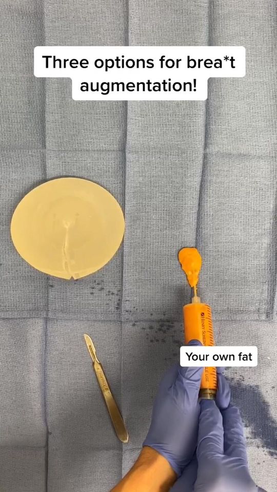 Video by Dr. Remus Repta: Three options for a brea*t augmentation 😍