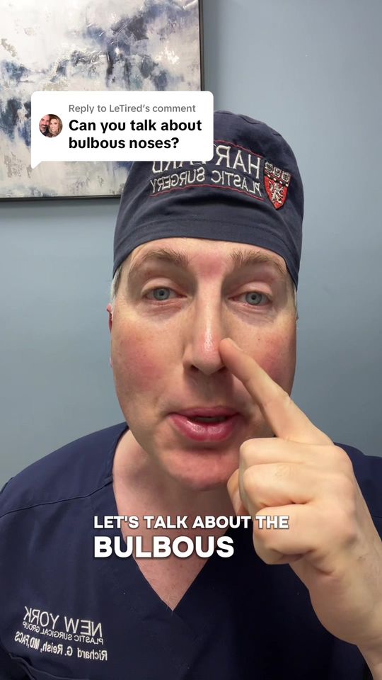 Video by Dr. Richard G. Reish: Replying to @LeTired bulbous nasal tip refinement in rhinoplasty.