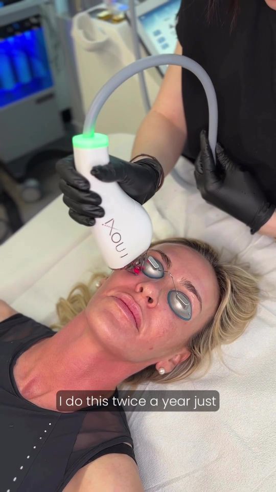 Video by Dr. Richard H. LeConey: Laura noticed her melasma after pregnancy, and like so many women, she wondered what to do to get…