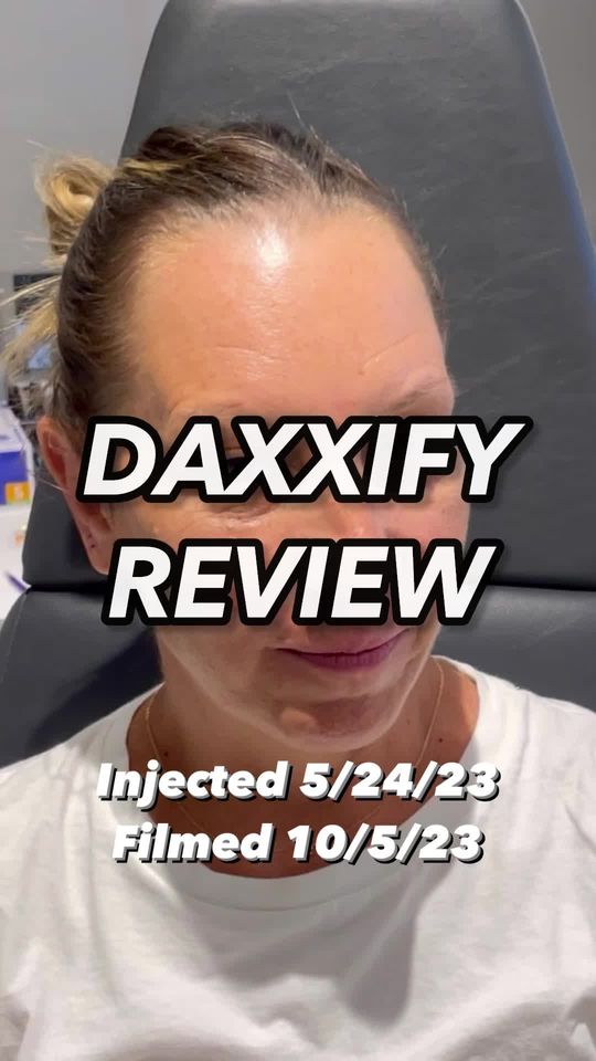 Video by Dr. Richard W. Westreich: Daxxify review. We treated three patients with samples in May and follow them in order to see the…