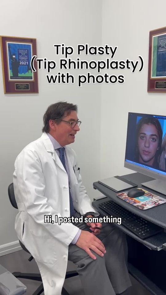 Video by Dr. Robert A. Guida: Tip-Plasty / Tip Rhinoplasty Dr. Robert Guida, NYC facial plastic surgeon and rhinoplasty expert…
