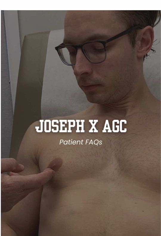 Video by Dr. Robert Caridi: Gynecomastia 101 ✅ Our amazing patient Joseph answers his most commonly asked post-op questions!