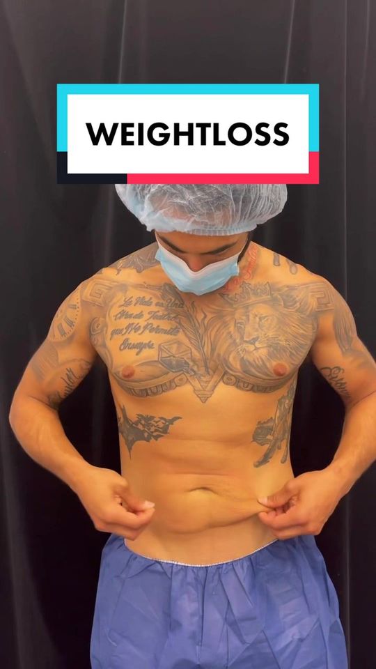 Video by Dr. Roger Tsai: Do you know what this procedure is called??