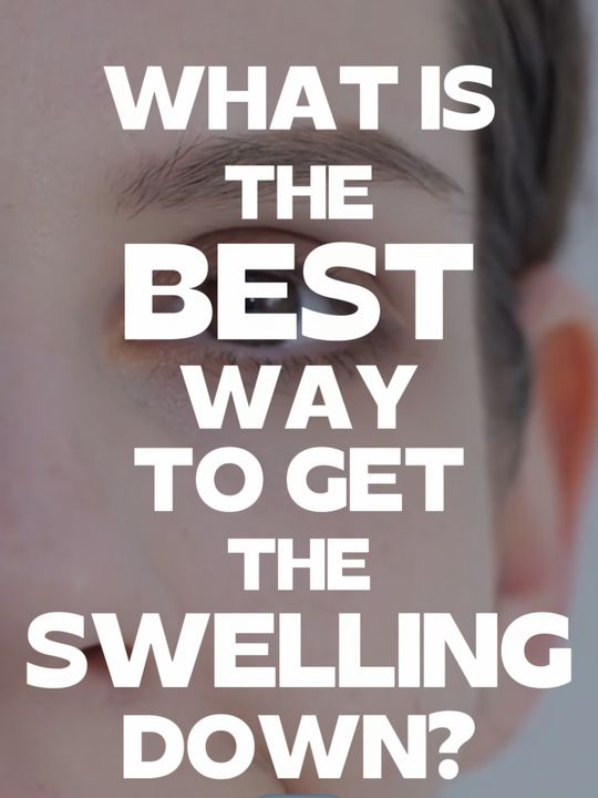 Video by Dr. Roy Kim: Lower eyelid swelling? Most people are doing this wrong. ❌ Pushing down won’t help your lymphatic…